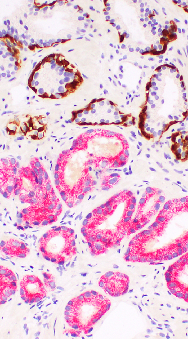 A microscopic image of tissue stained to reveal specific proteins within cells.